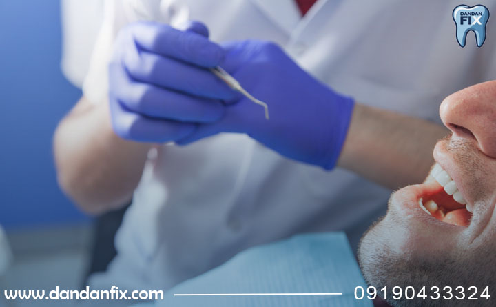 مزایای ایمپلنت دو مرحله ای