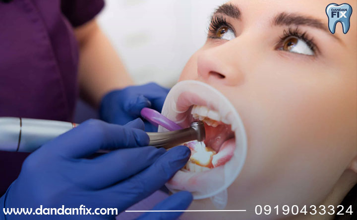 اگر کامپوزیت افتاد چیکار کنیم؟