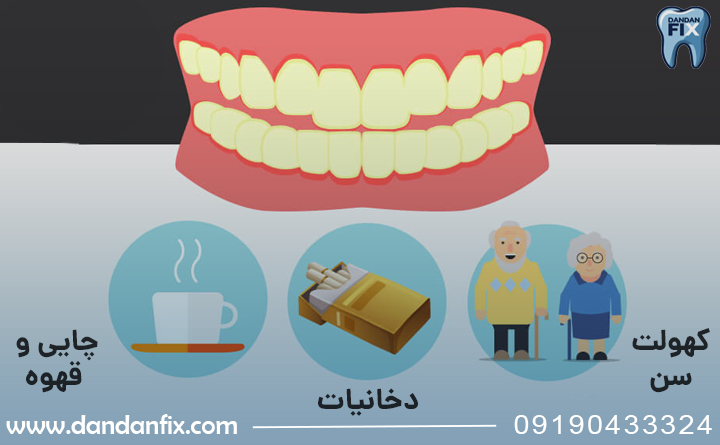 چرا دندان ها زرد میشن