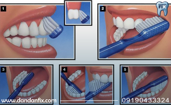 نحوه درست مسواک زدن 