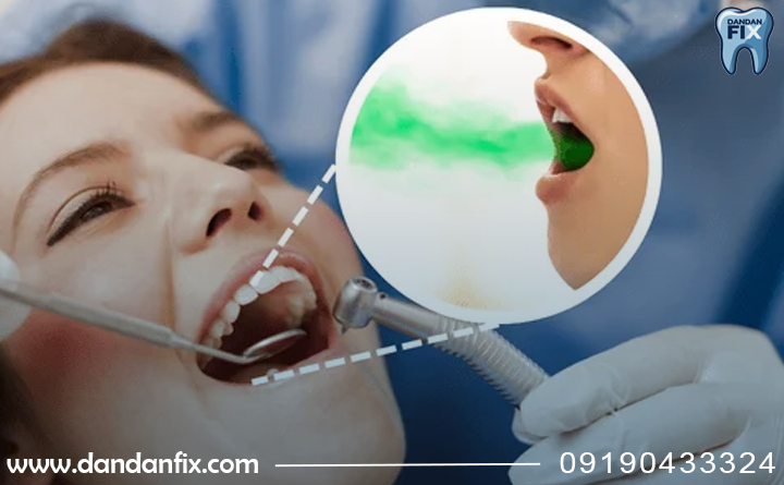 درمان بوی بد دهان