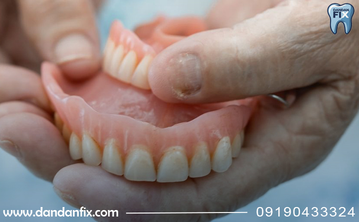 مزایا و معایب دندان مصنوعی معمولی