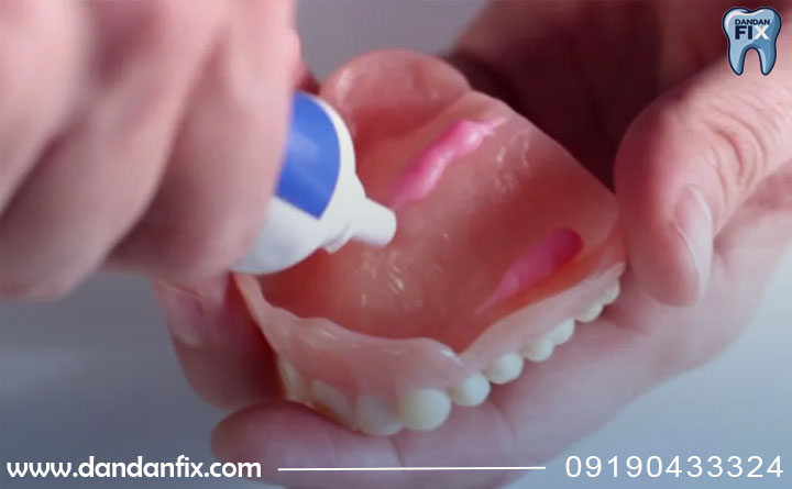 دندان چسبی خوبه؟