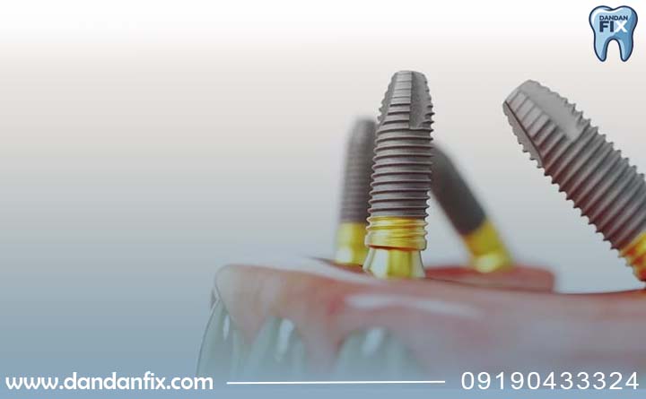 مزایا و معایب نوبل