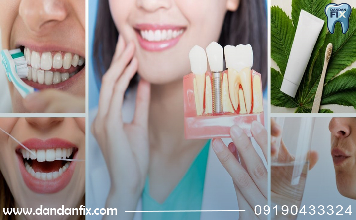 مراقبتاز ایمپلنت