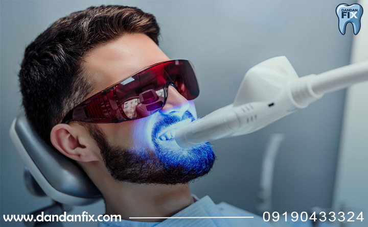 روش‌های تخصصی  رفع زردی دندان