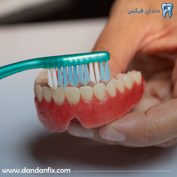 بهترین روش های مراقبت از دندان مصنوعی - بایدها و نبایدها