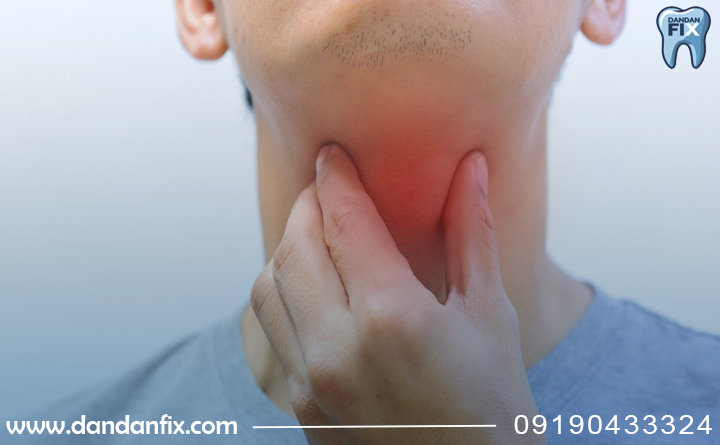 گلو درد بعد از گذاشتن دندان مصنوعی