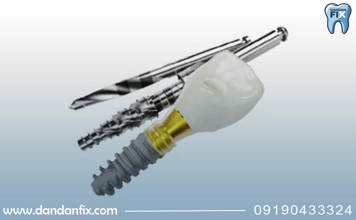 ویژگی ایمپلنت بیوکر