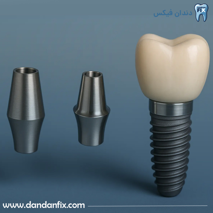 ایمپلنت نئودنت برزیل Neodent + بررسی کیفیت و قیمت ایمپلنت نئودنت