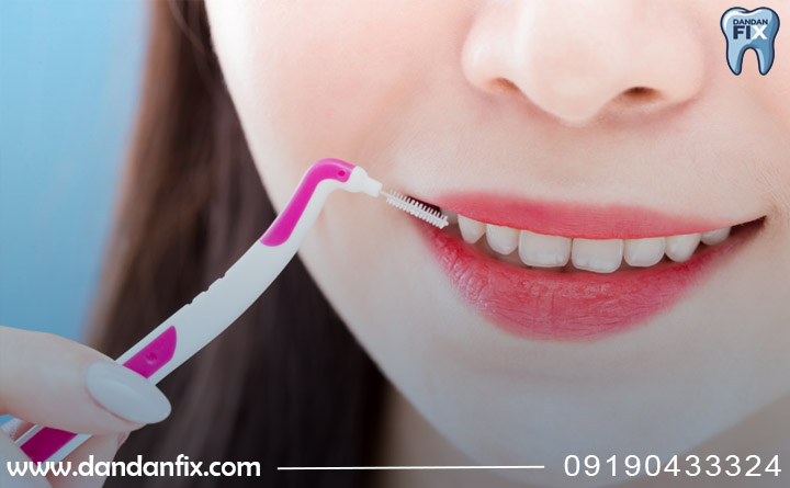 مسواک زدن بریج