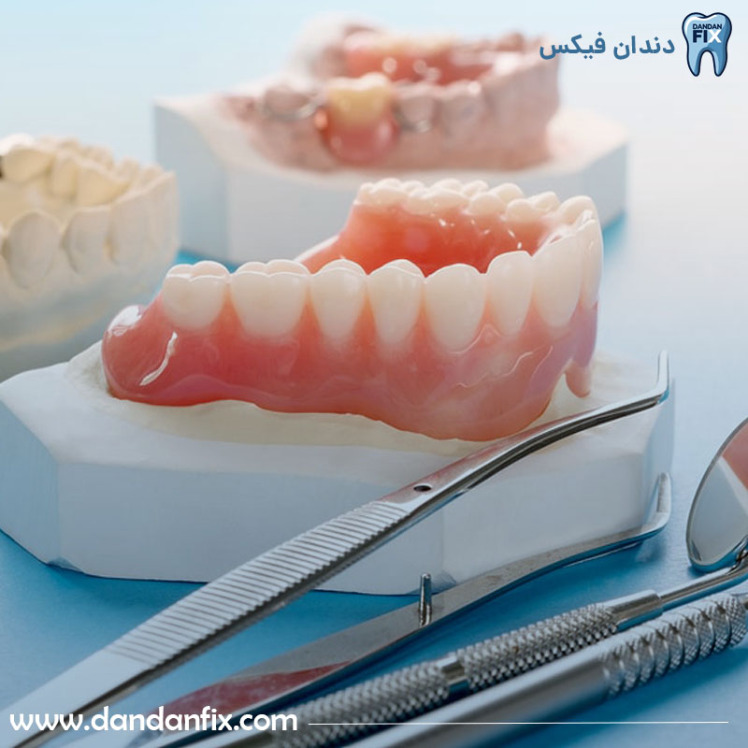 دندان مصنوعی ثابت چسبی چیست؟ + همه چیز درباره دندان مصنوعی چسبی