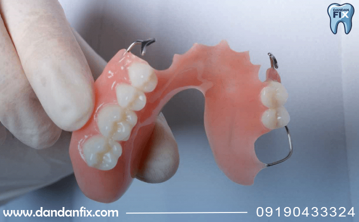 چرا باید دندان مصنوعی پارسیل بذاریم؟