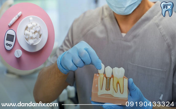 قیمت دندان مصنوعی