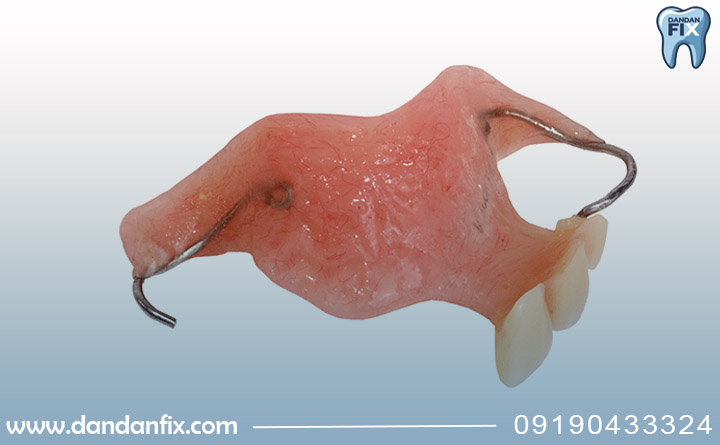 فلیپر دندان تکی