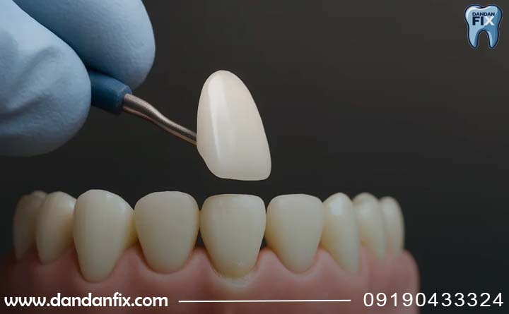 مزایا و معایب لمینت 