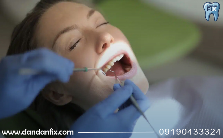 مراجل انجام بریج دندان