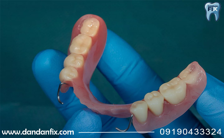 مزایای دست دندون متحرک