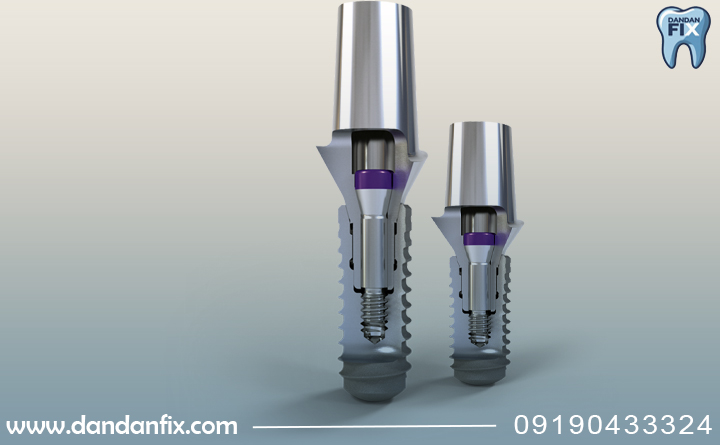 ویژگی های ایمپلنت اشترومن