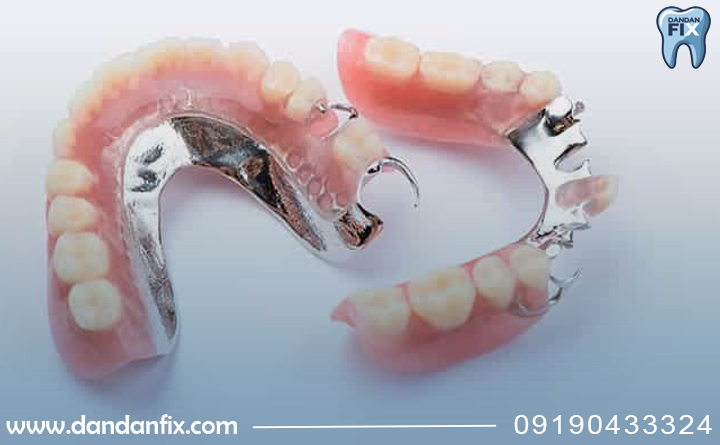 بهترین جنس پروتز پارسیل