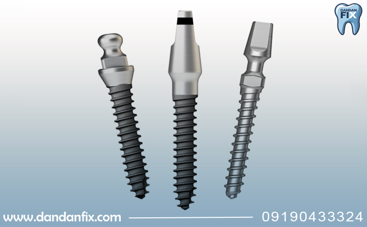 قیمت ایمپلنت آستم در ایران