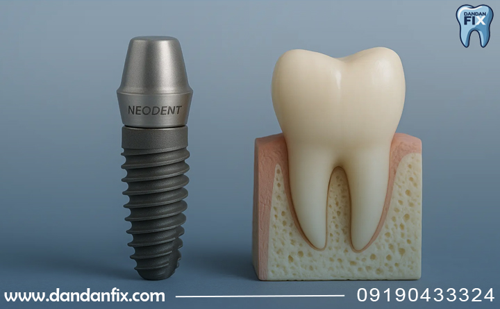 ایمپلنت neodent